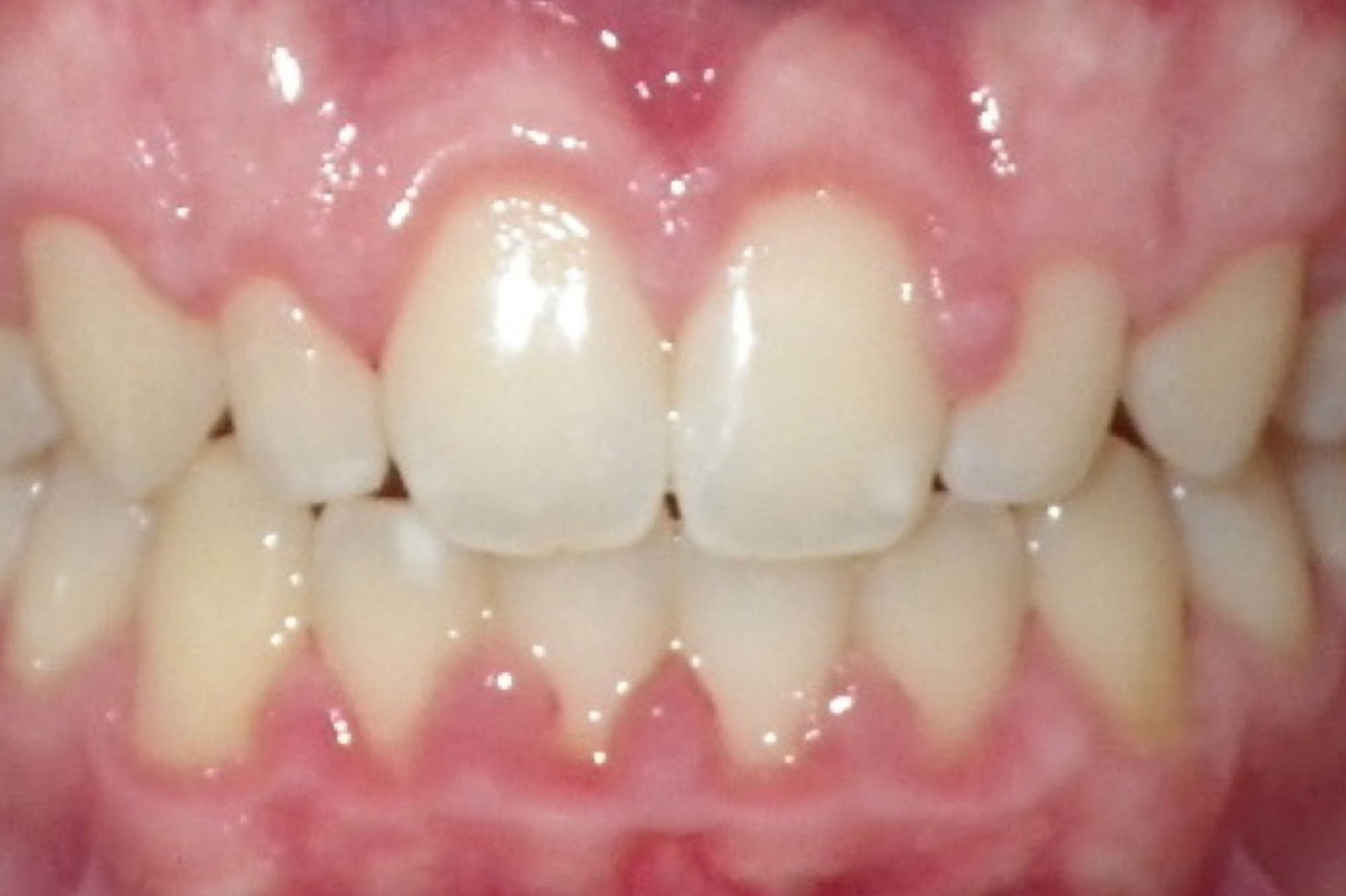 Original Image
