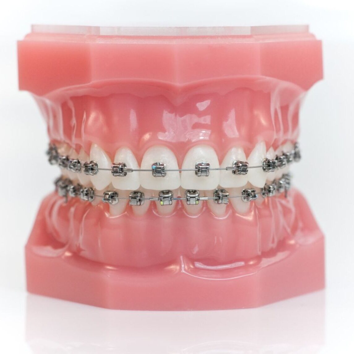 The Benefits of an Aligned Bite