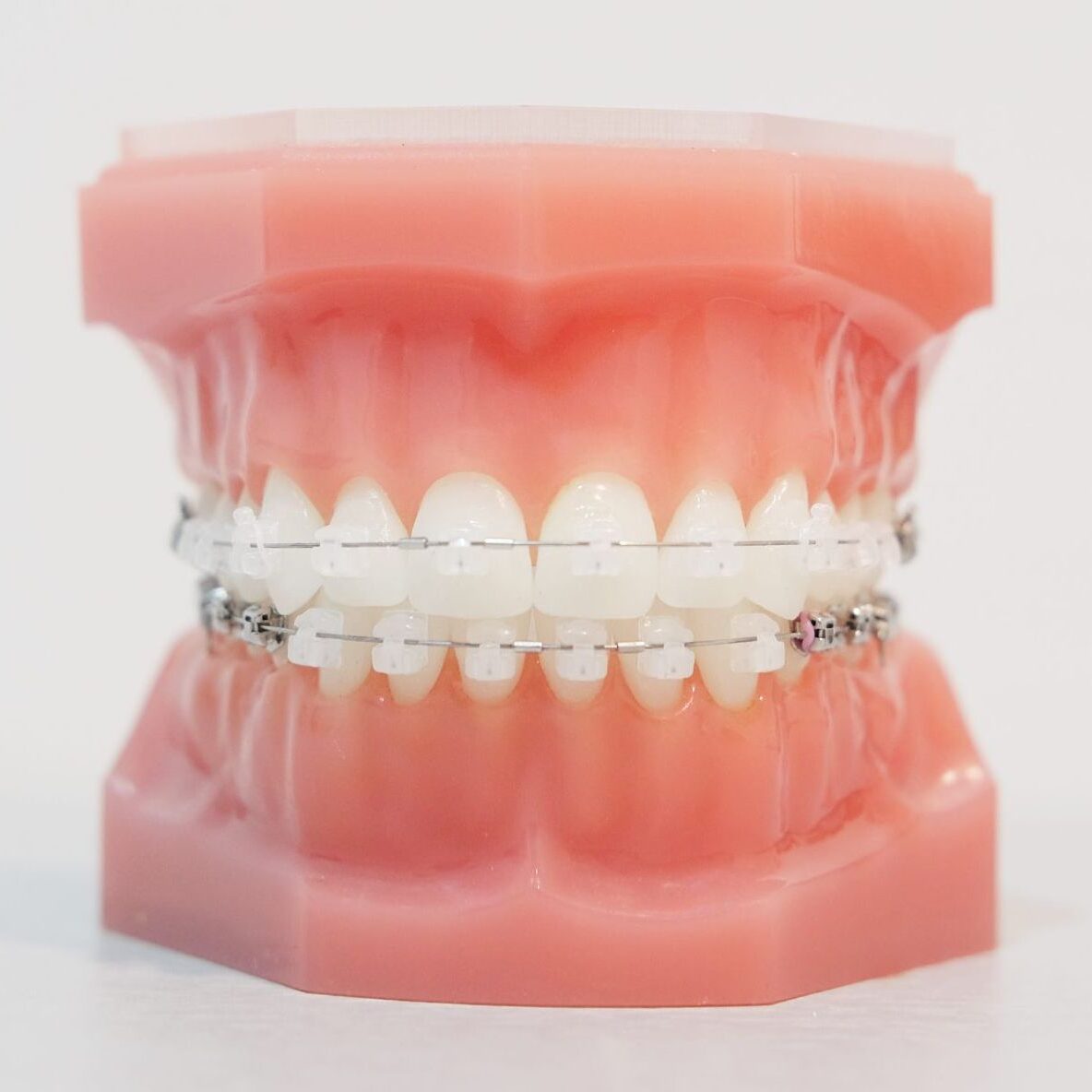 The Benefits of an Aligned Bite